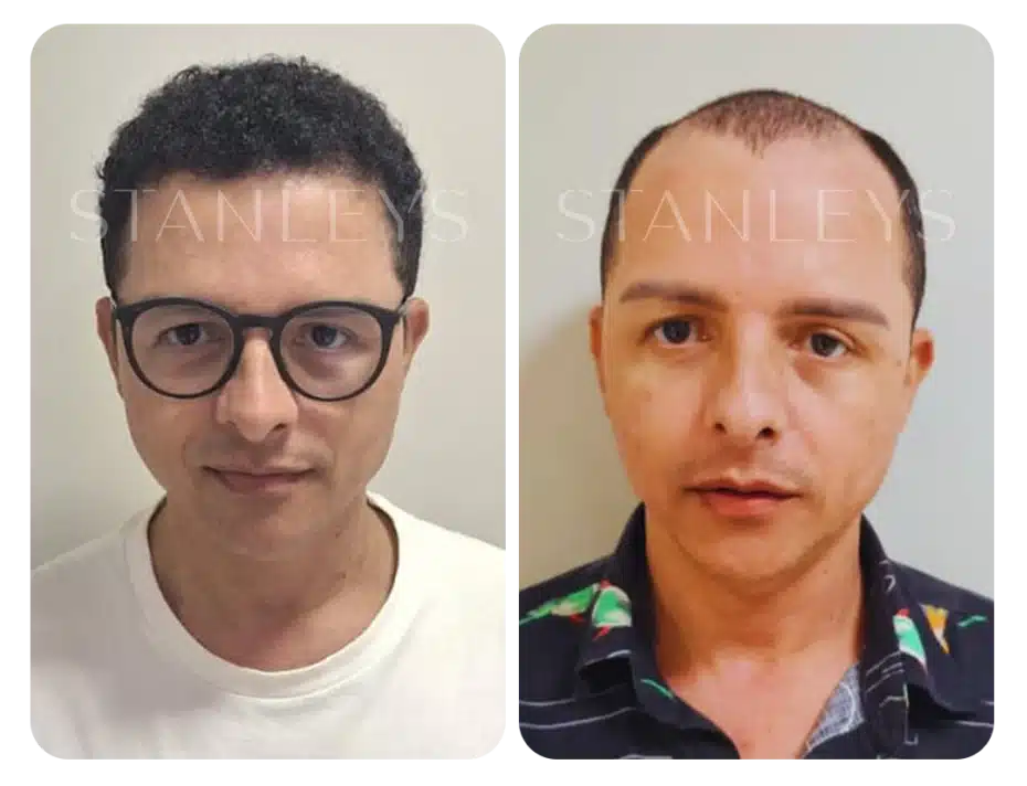 antes_e_depois_lp_02_2x.webp
